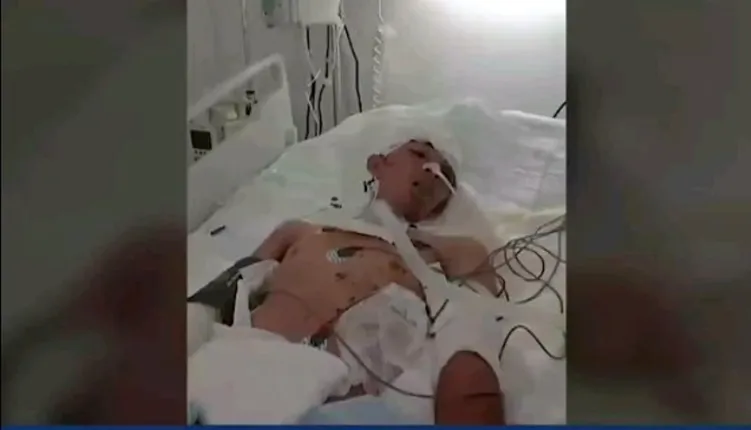 Venezolano