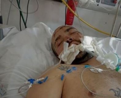 Venezolano que fue arrollado en Argentina se encuentra grave: El conductor se disparó en la cabeza