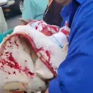 Tres personas resultaron gravemente heridas tras sicariato en Perú: Una bebé de seis meses salió ilesa