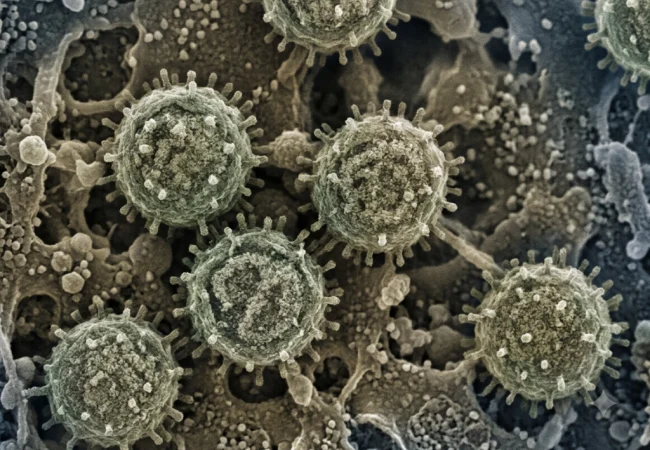 ¿Qués es el hantivirus?
