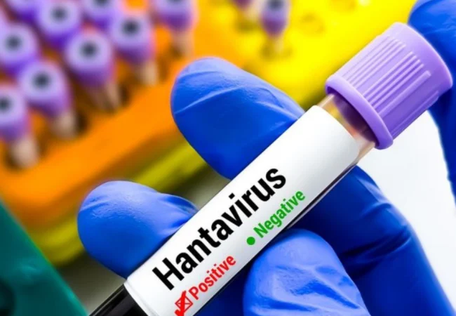 El Hantavirus no se transmite de persona a persona: Según especialistas