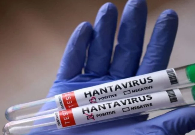 Ministerio de Salud confirmó tres fallecidos por Hantavirus en Anzoátegui